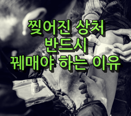 찢어진 상처 꿰매는 이유
